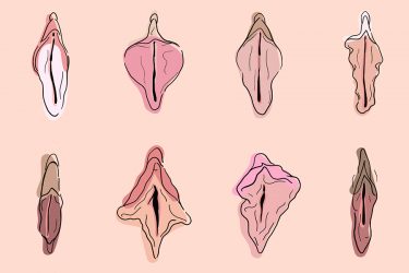 Diferentes tipos de vulvas