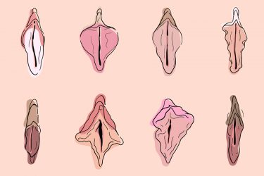 Diferentes tipos de vulvas