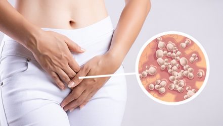 ¿Qué es el herpes?